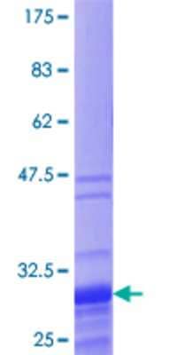 SDS-Page: Recombinant Human TNP1 Protein [H00007141-P01] - 12.5% SDS-PAGE Stained with Coomassie Blue.