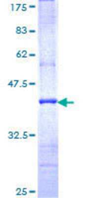 12.5% SDS-PAGE Stained with Coomassie Blue.