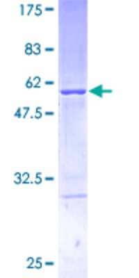 12.5% SDS-PAGE Stained with Coomassie Blue.