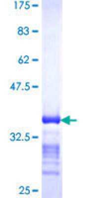 SDS-Page: Recombinant Human TPD52 Protein [H00007163-Q01] - 12.5% SDS-PAGE Stained with Coomassie Blue.