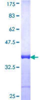 12.5% SDS-PAGE Stained with Coomassie Blue.