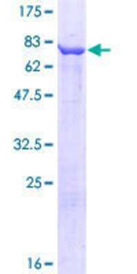 12.5% SDS-PAGE Stained with Coomassie Blue.