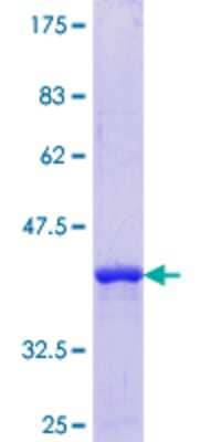 SDS-Page: Recombinant Human TSPYL1 Protein [H00007259-Q01] - 12.5% SDS-PAGE Stained with Coomassie Blue.