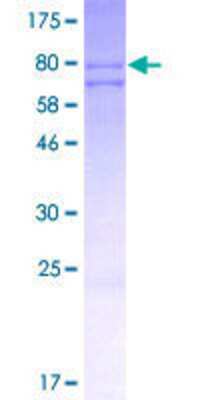Other Recombinant Human DNAJC7 GST (N-Term) Protein