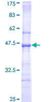 SDS-Page: Recombinant Human TTC3 Protein [H00007267-Q01] - 12.5% SDS-PAGE Stained with Coomassie Blue.