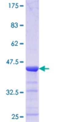 SDS-Page: Recombinant Human TTC4 Protein [H00007268-Q01] - 12.5% SDS-PAGE Stained with Coomassie Blue.