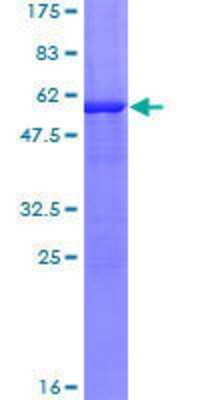 12.5% SDS-PAGE Stained with Coomassie Blue.