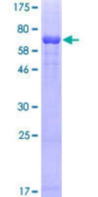 Unknown Recombinant Human alpha Tubulin 4a GST (N-Term) Protein