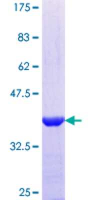 SDS-Page: Recombinant Human Tuftelin 1 Protein [H00007286-Q01] - 12.5% SDS-PAGE Stained with Coomassie Blue.