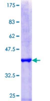 SDS-Page: Recombinant Human HIRA Protein [H00007290-Q01] - 12.5% SDS-PAGE Stained with Coomassie Blue.