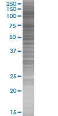 HIRA transfected lysate.