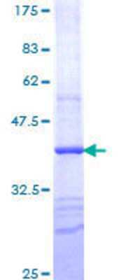 12.5% SDS-PAGE Stained with Coomassie Blue.