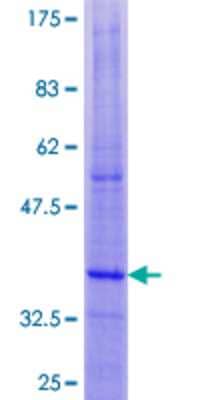 12.5% SDS-PAGE Stained with Coomassie Blue.