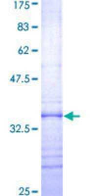 12.5% SDS-PAGE Stained with Coomassie Blue.