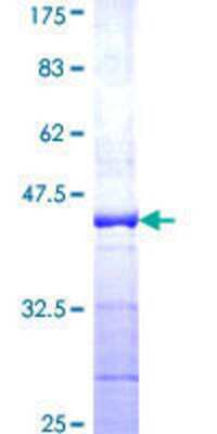 12.5% SDS-PAGE Stained with Coomassie Blue.