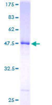 SDS-Page: Recombinant Human UBE2E2 Protein [H00007325-P01] - 12.5% SDS-PAGE Stained with Coomassie Blue.