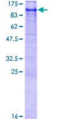 Other Recombinant Human E6AP/UBE3A GST (N-Term) Protein