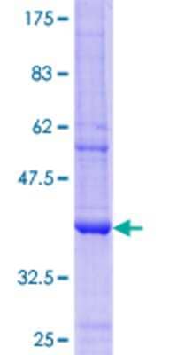 Other Recombinant Human UGT2B4 GST (N-Term) Protein