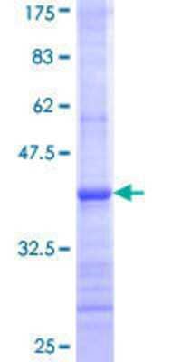 Other Recombinant Human UGT2B7 GST (N-Term) Protein