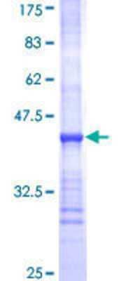 Other Recombinant Human UGT2B10 GST (N-Term) Protein