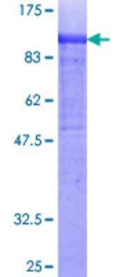Other Recombinant Human COL14A1 GST (N-Term) Protein