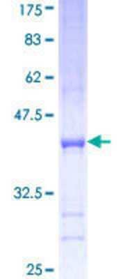 SDS-Page: Recombinant Human VARS Protein [H00007407-Q01] - 12.5% SDS-PAGE Stained with Coomassie Blue.