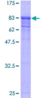 12.5% SDS-PAGE Stained with Coomassie Blue.