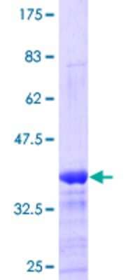 12.5% SDS-PAGE Stained with Coomassie Blue.