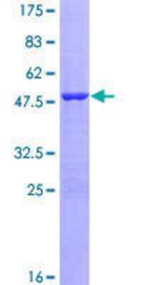 12.5% SDS-PAGE Stained with Coomassie Blue.