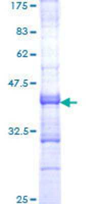 12.5% SDS-PAGE Stained with Coomassie Blue.