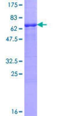 Other Recombinant Human VRK1 GST (N-Term) Protein