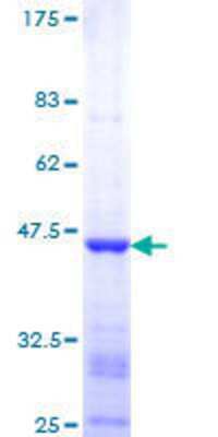 SDS-Page: Recombinant Human VRK1 Protein [H00007443-Q01] - 12.5% SDS-PAGE Stained with Coomassie Blue.