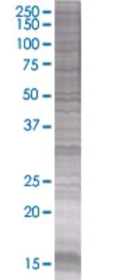 Other Von Willebrand Factor 293T Cell Transient Overexpression Lysate