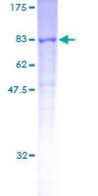 12.5% SDS-PAGE Stained with Coomassie Blue.