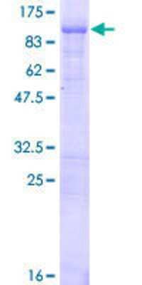 12.5% SDS-PAGE Stained with Coomassie Blue.