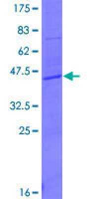 12.5% SDS-PAGE Stained with Coomassie Blue.