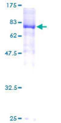 12.5% SDS-PAGE Stained with Coomassie Blue.