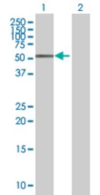 Lane 1: ZFP161 transfected lysate (51 KDa) Lane 2: Non-transfected lysate.
