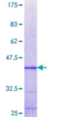 Other Recombinant Human ZNF10 GST (N-Term) Protein
