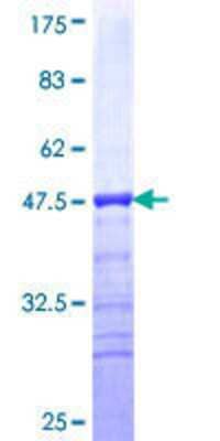 SDS-Page: Recombinant Human ZNF12 Protein [H00007559-Q01] - 12.5% SDS-PAGE Stained with Coomassie Blue.