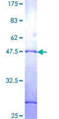 12.5% SDS-PAGE Stained with Coomassie Blue.