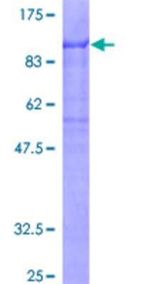 12.5% SDS-PAGE Stained with Coomassie Blue.