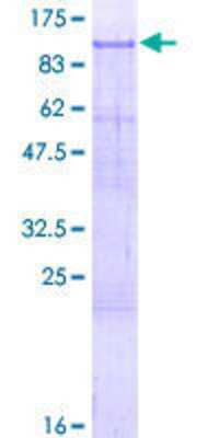 12.5% SDS-PAGE Stained with Coomassie Blue.