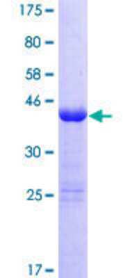Other Recombinant Human ZNF69 GST (N-Term) Protein