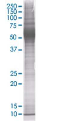ZNF70 transfected lysate