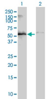 Lane 1: ZNF70 transfected lysate (49.17 KDa). Lane 2: Non-transfected lysate.