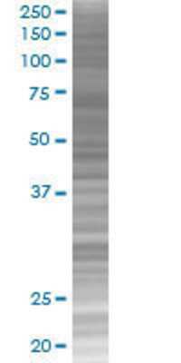 ZNF74 transfected lysate.