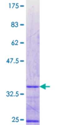 SDS-Page: Recombinant Human ZNF75 Protein [H00007626-Q01] - 12.5% SDS-PAGE Stained with Coomassie Blue.