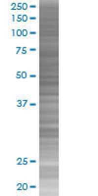 ZNF84 transfected lysate.