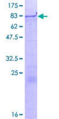 Other Recombinant Human ZNF85 GST (N-Term) Protein